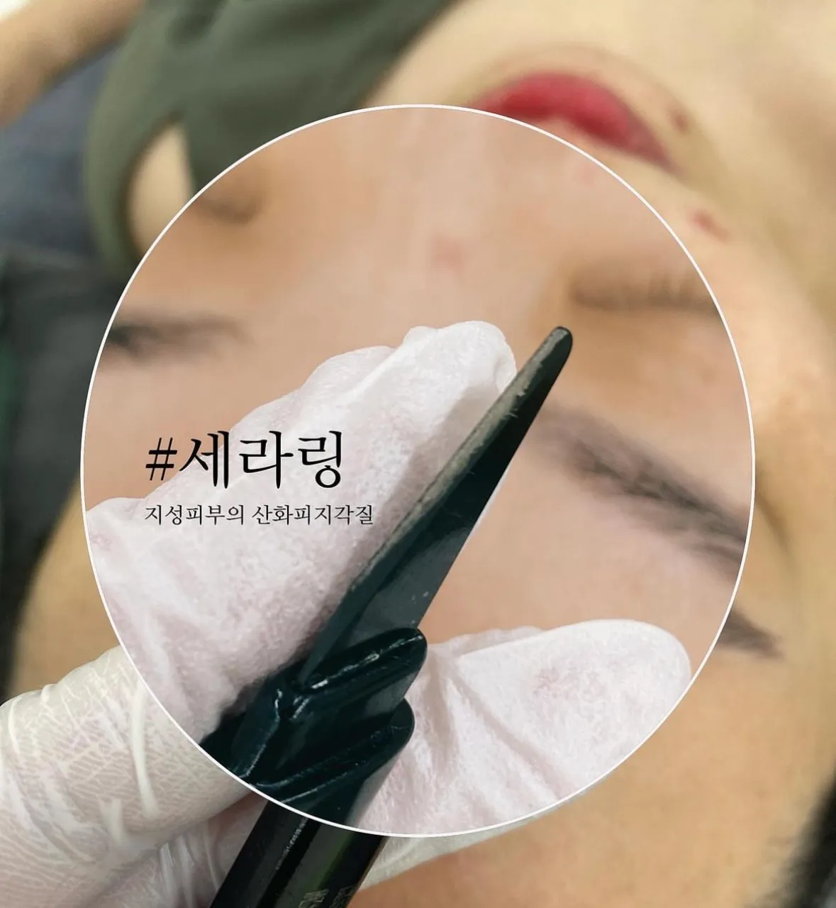 이미지 5