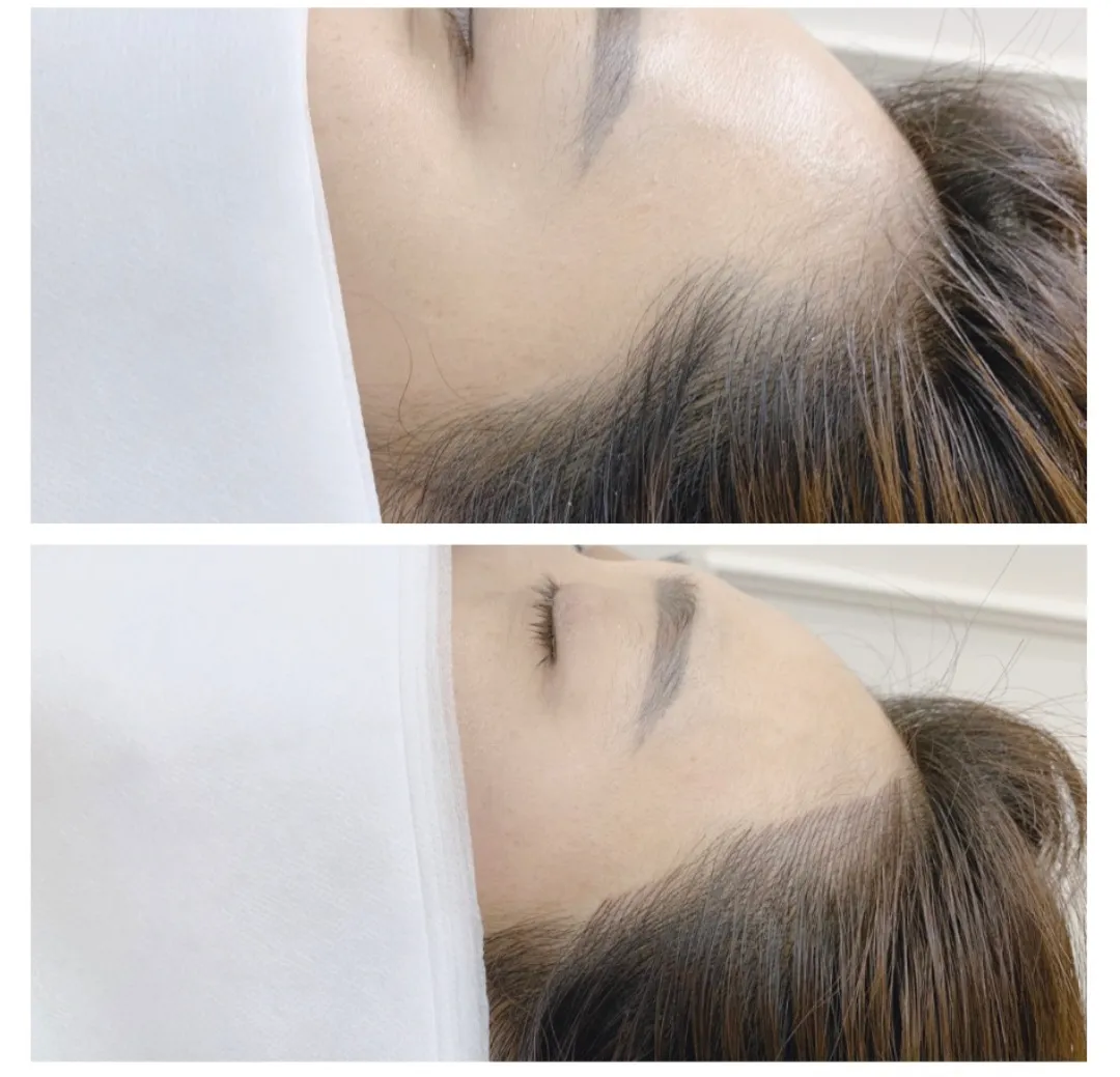 이미지 7