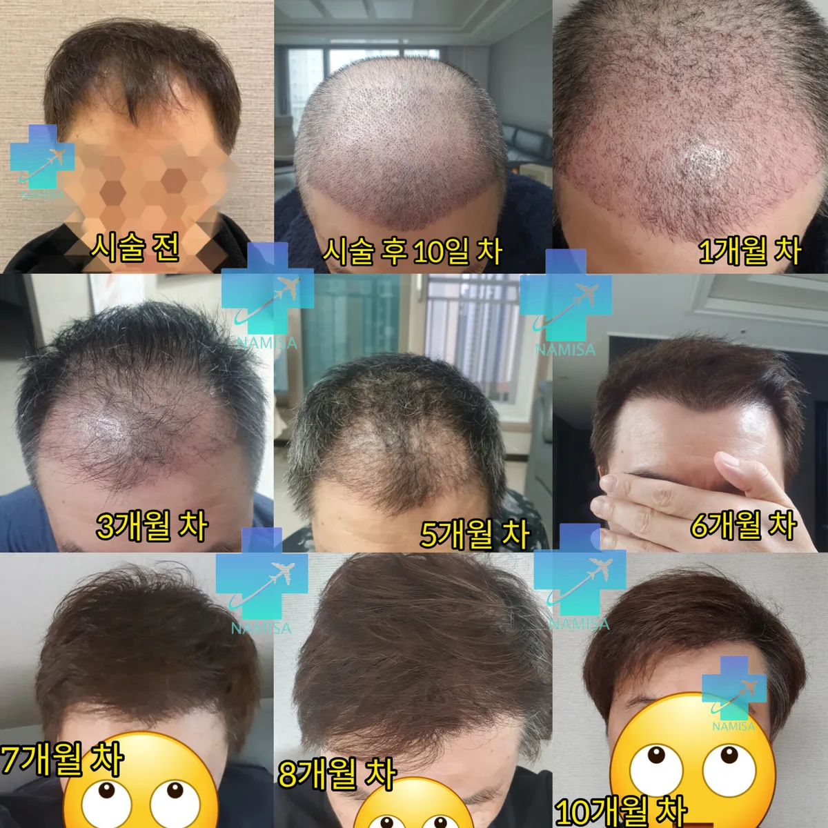 이미지 6