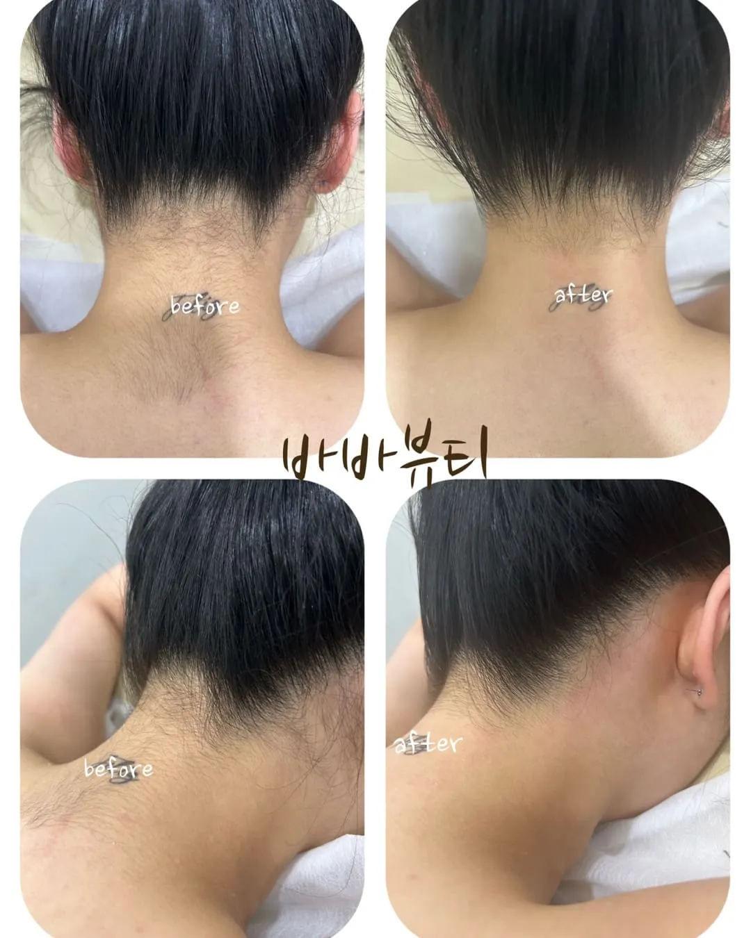 이미지 9