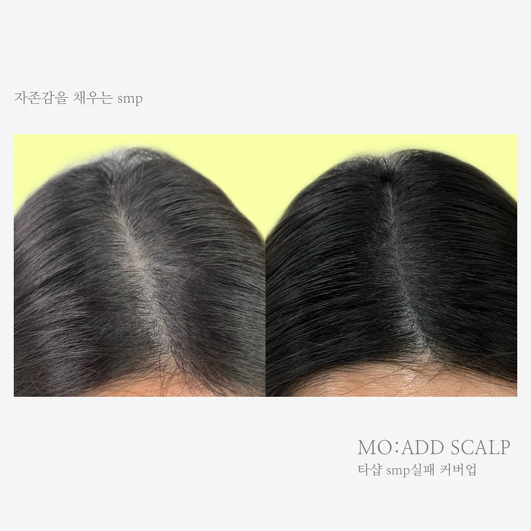 이미지 11