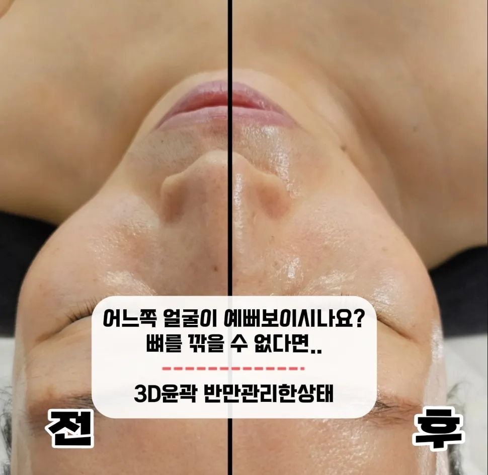 이미지 6