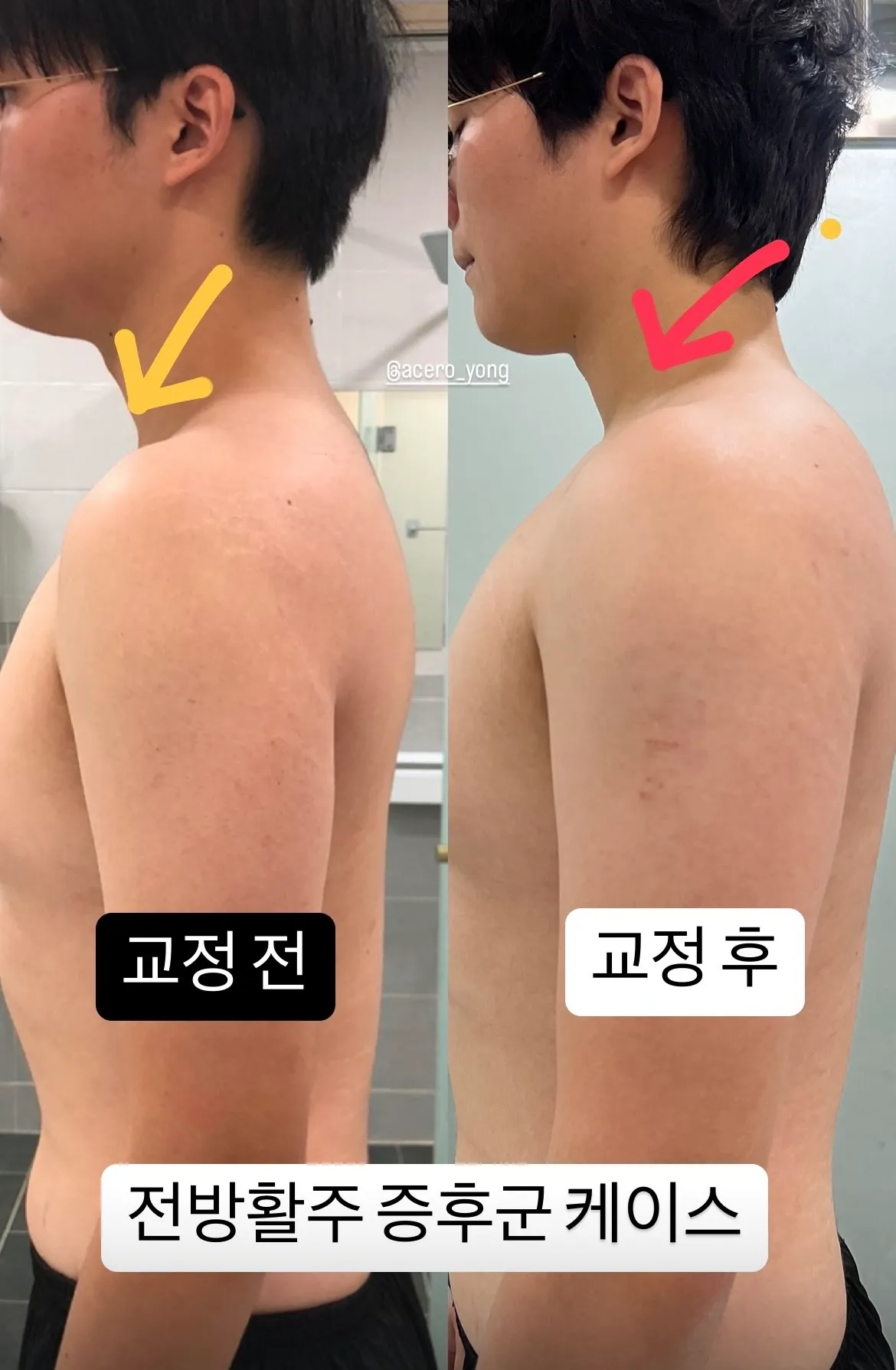 이미지 6