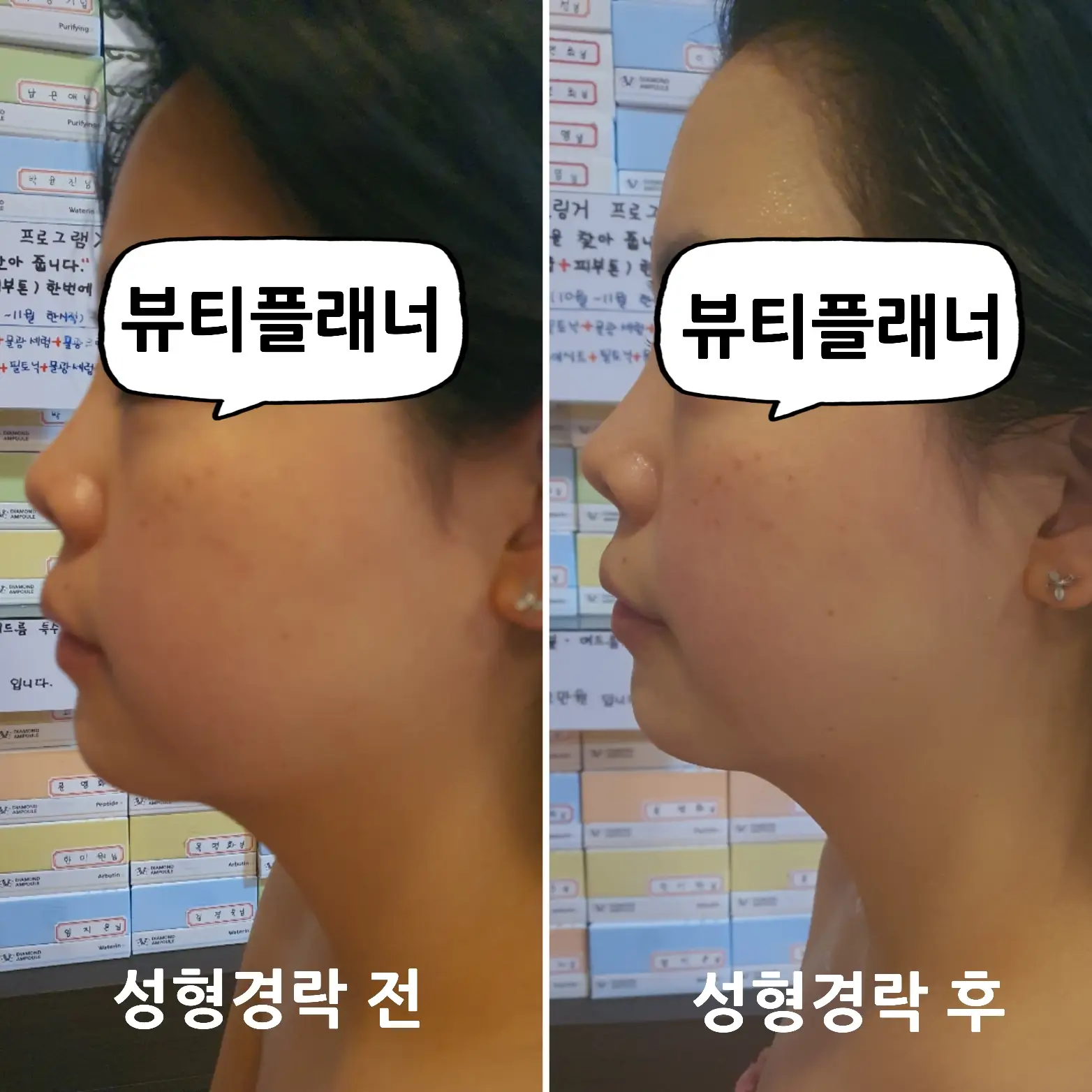 이미지 5