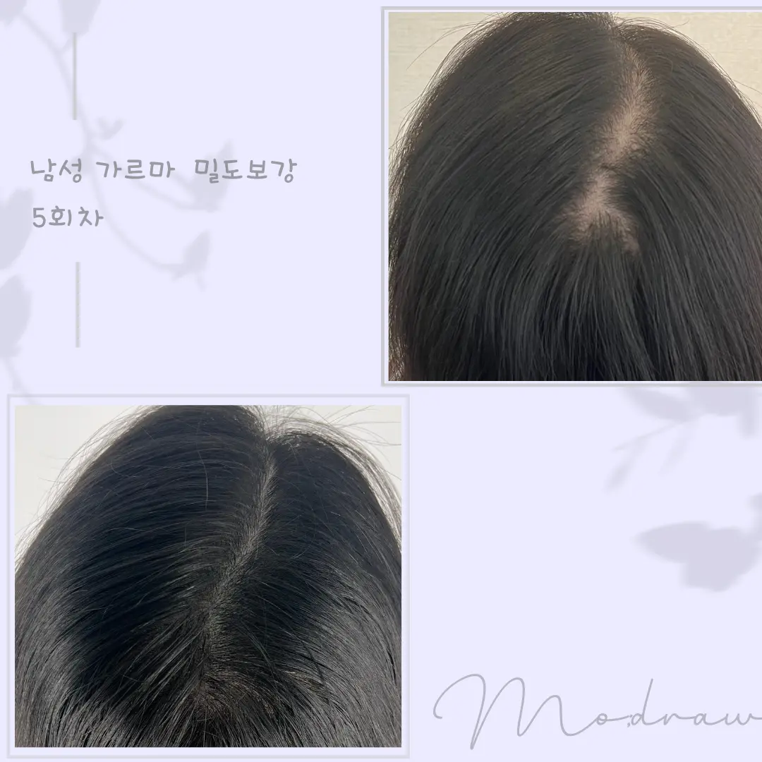 이미지 4