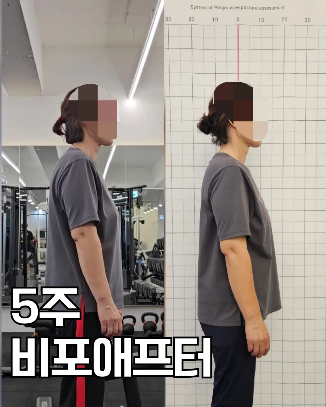 이미지 11