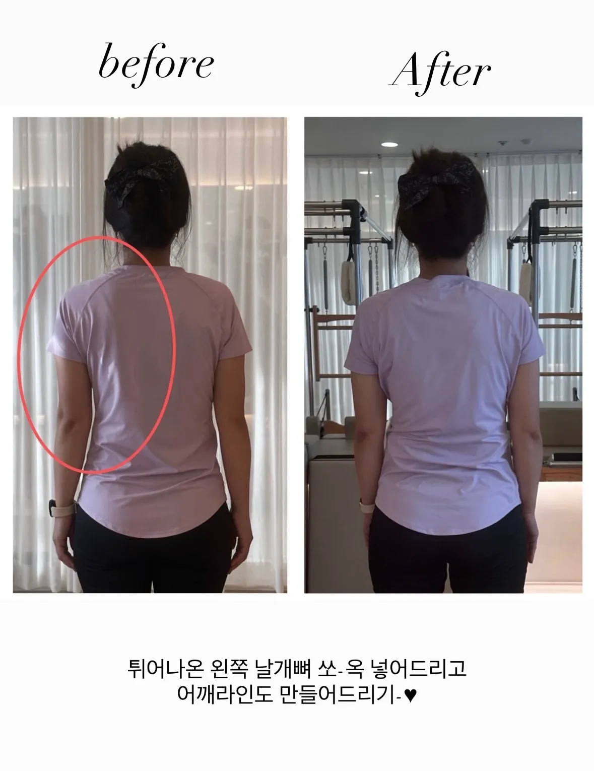 이미지 12