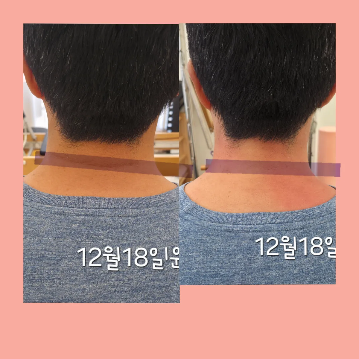 이미지 7