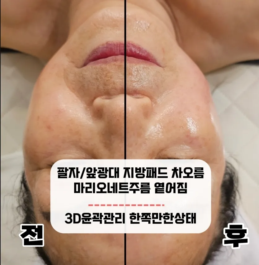 이미지 5