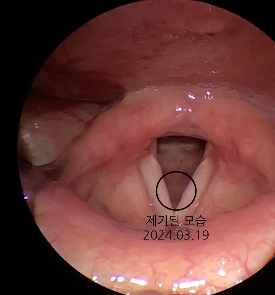 이미지 5