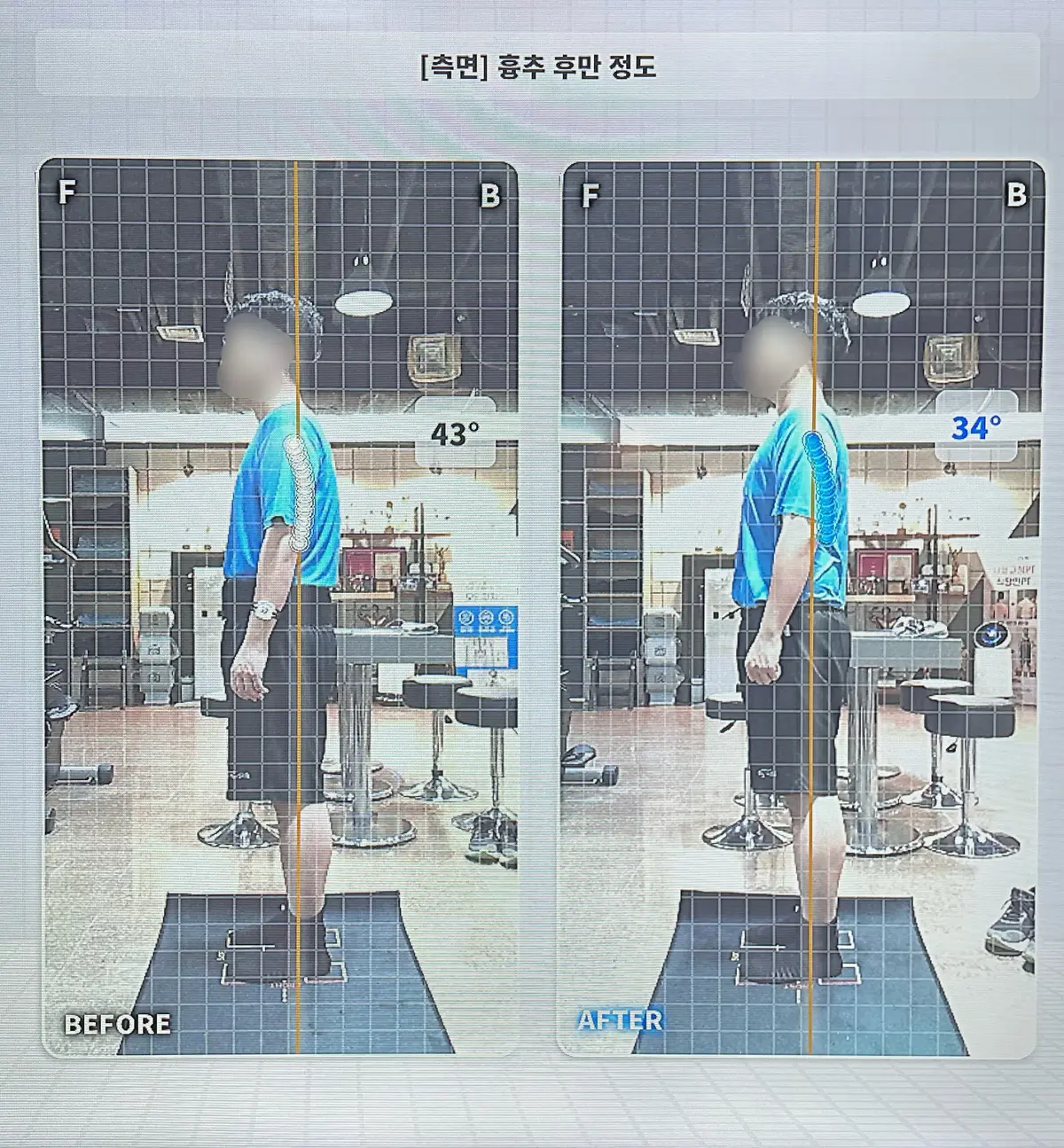 이미지 10