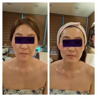 얼굴 경락으로 완성하는 입체적인 윤곽과 빛나는 피부