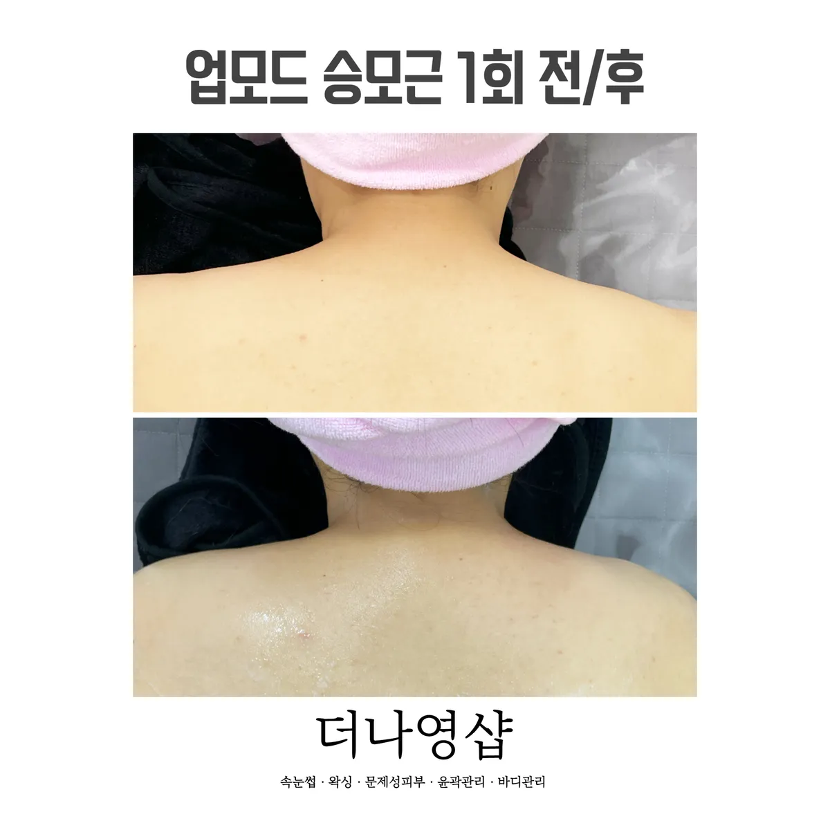 이미지 10