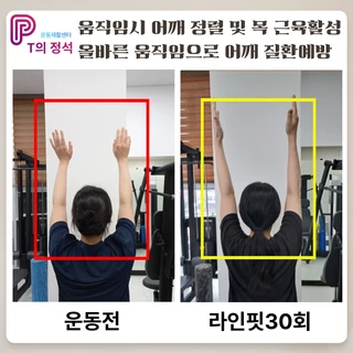 거북목,골반허리당김 개선, 라인핏30회