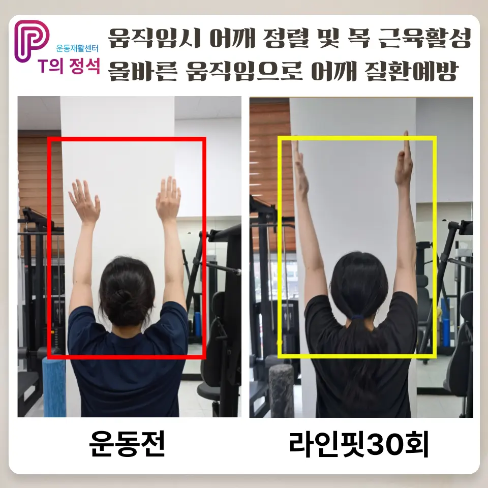 이미지 6