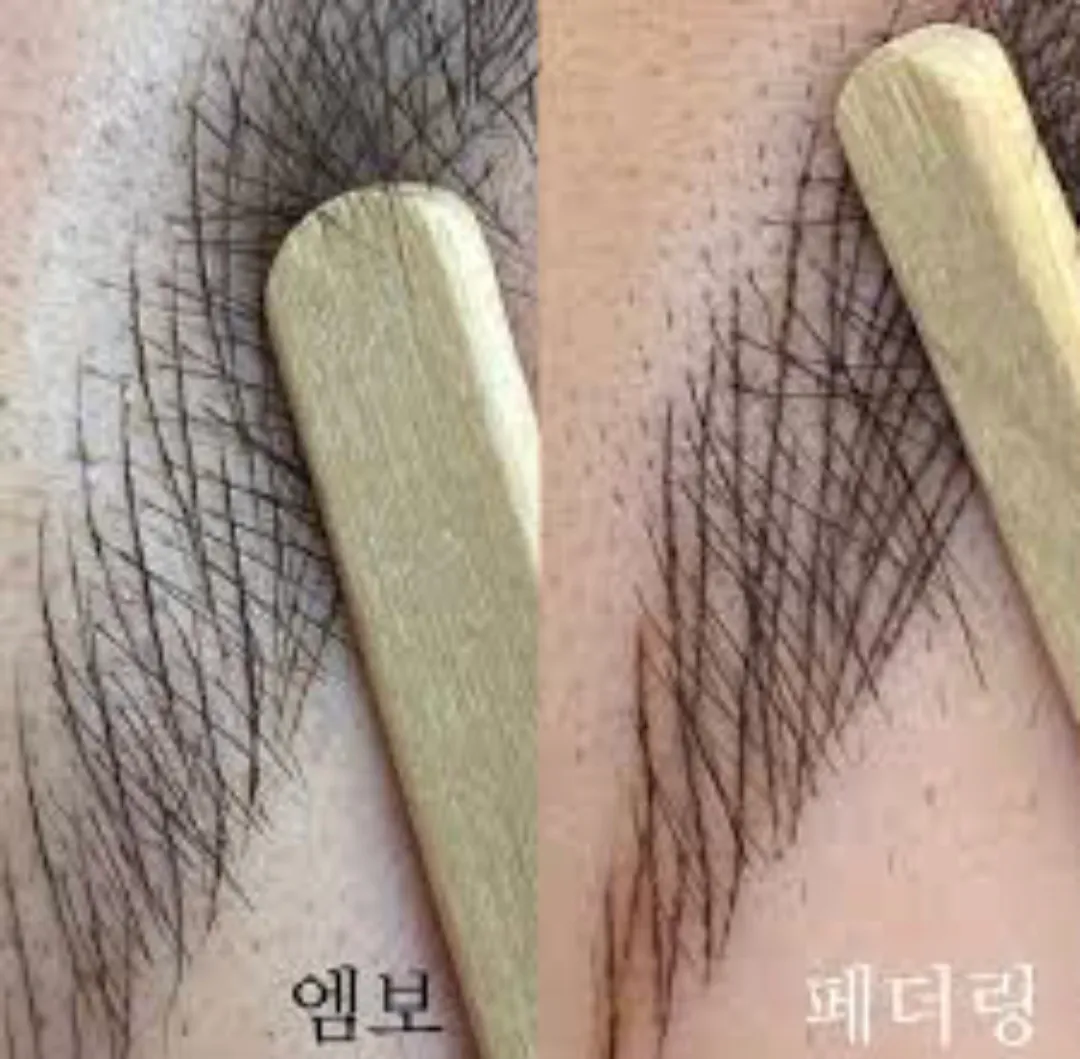 이미지 9