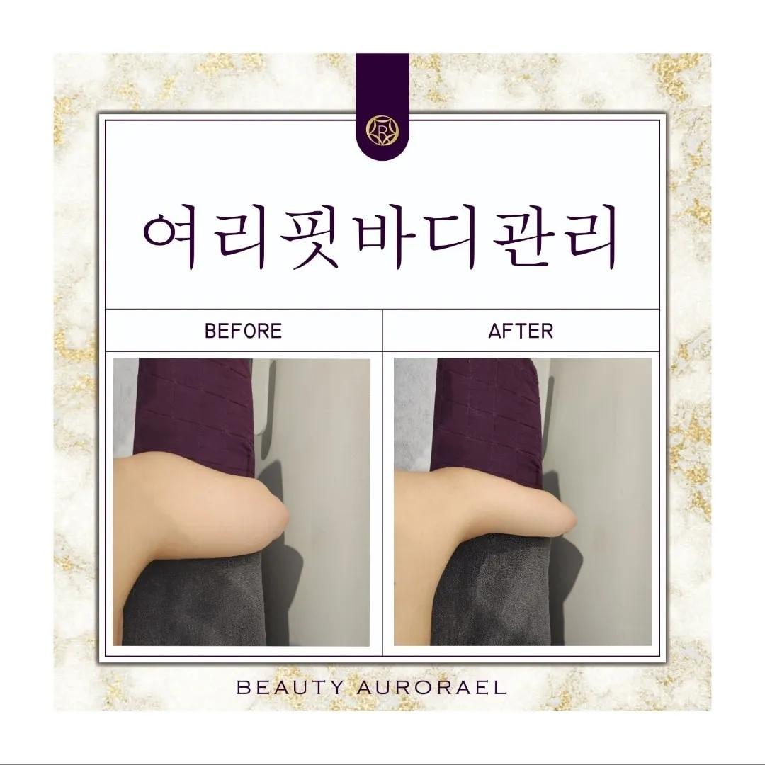 이미지 7