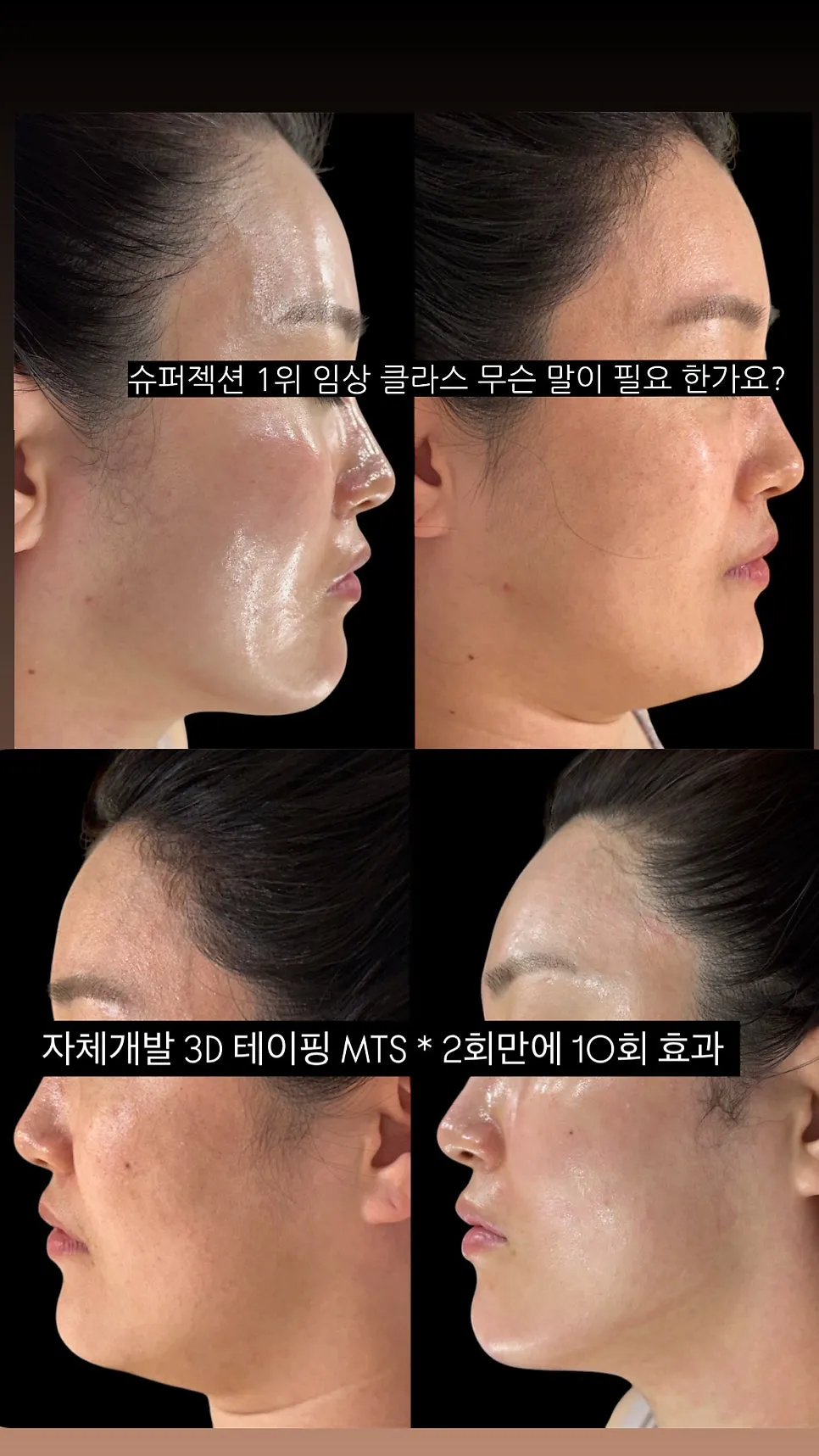 이미지 2