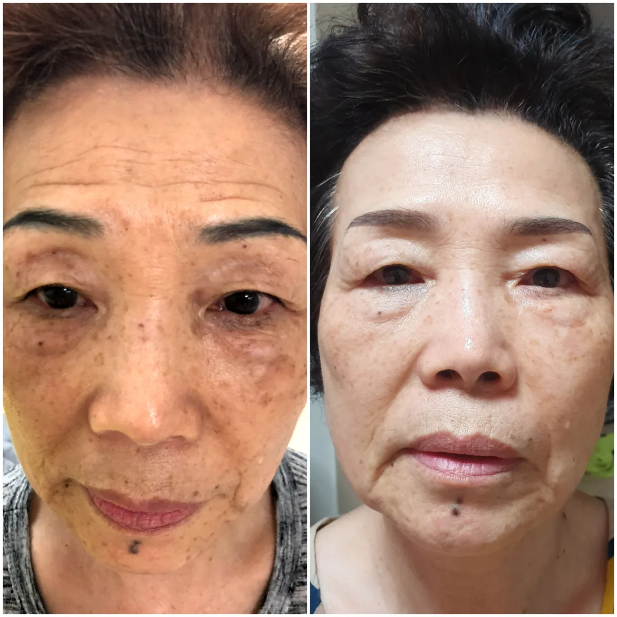 이미지 7