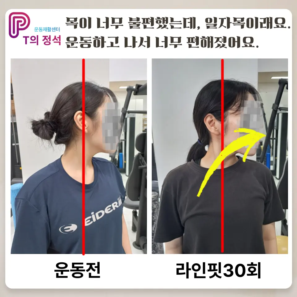 이미지 18