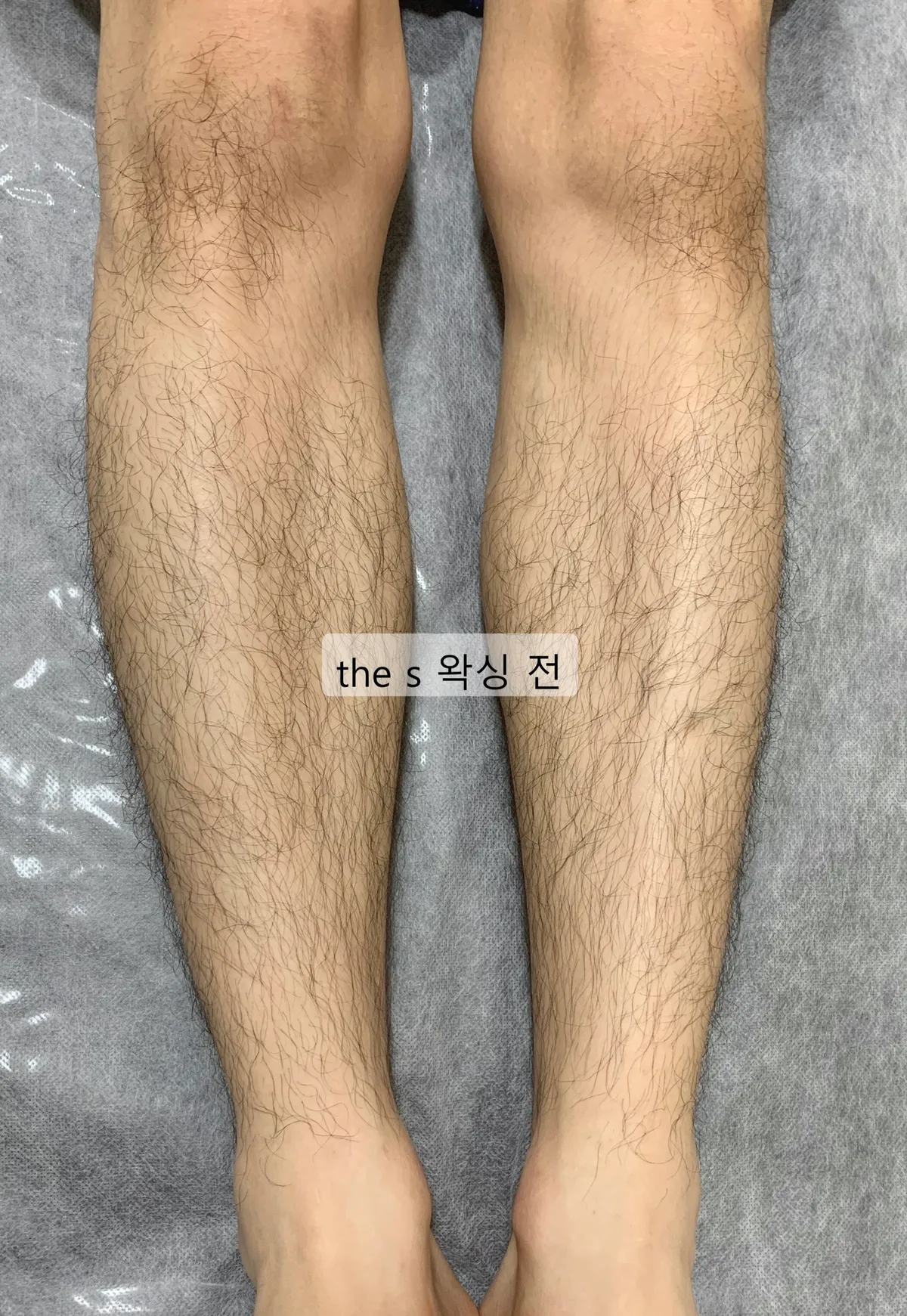이미지 7