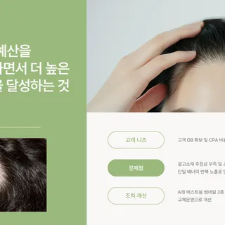 모발이식 마케팅