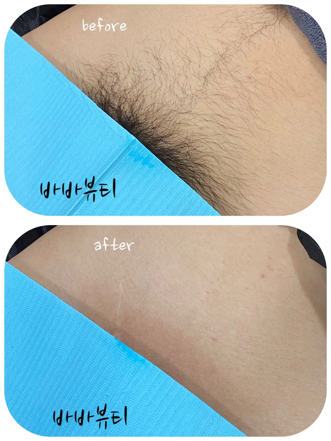 이미지 8