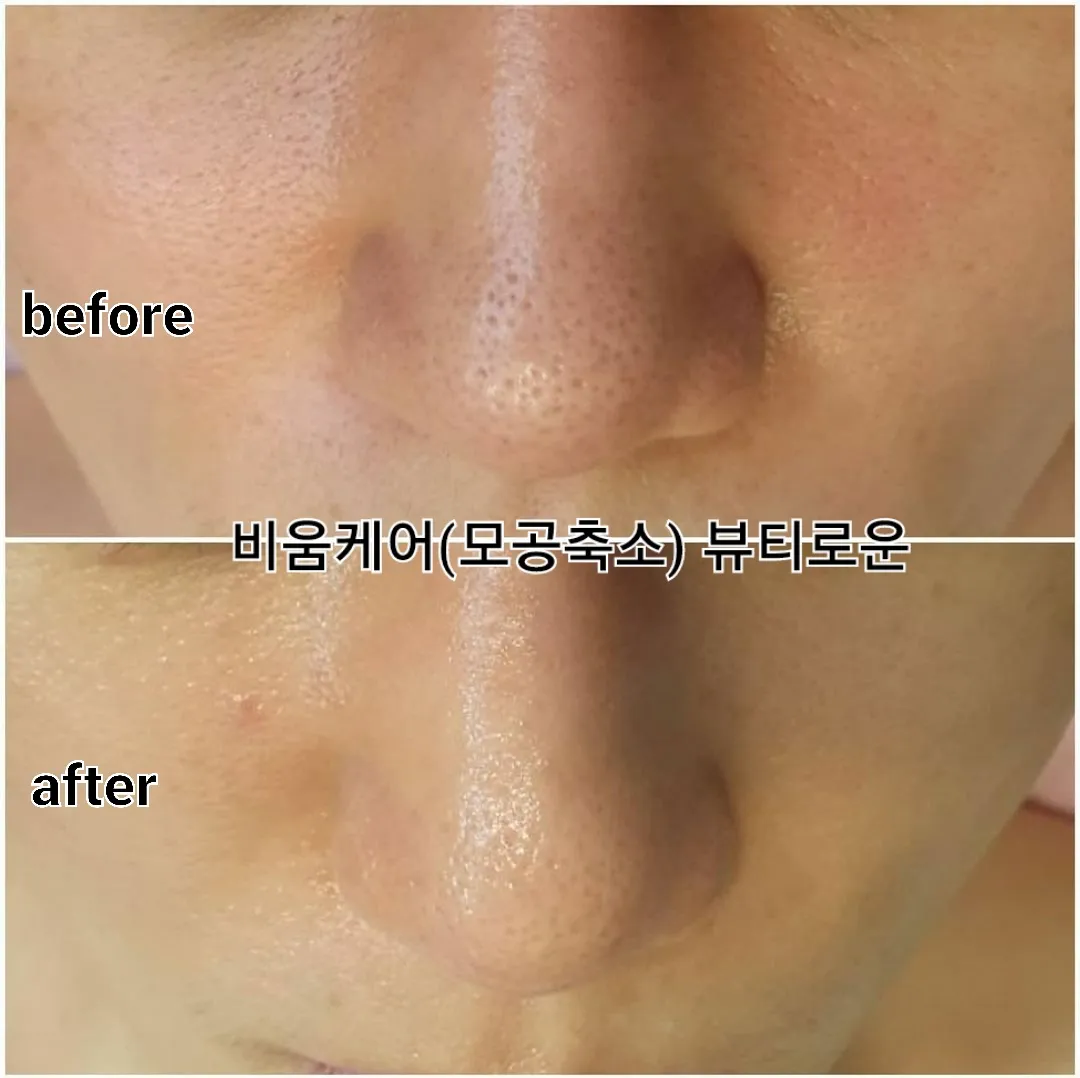 이미지 9