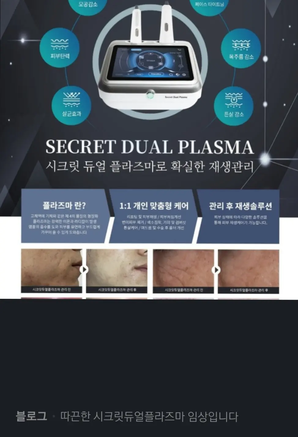 이미지 4