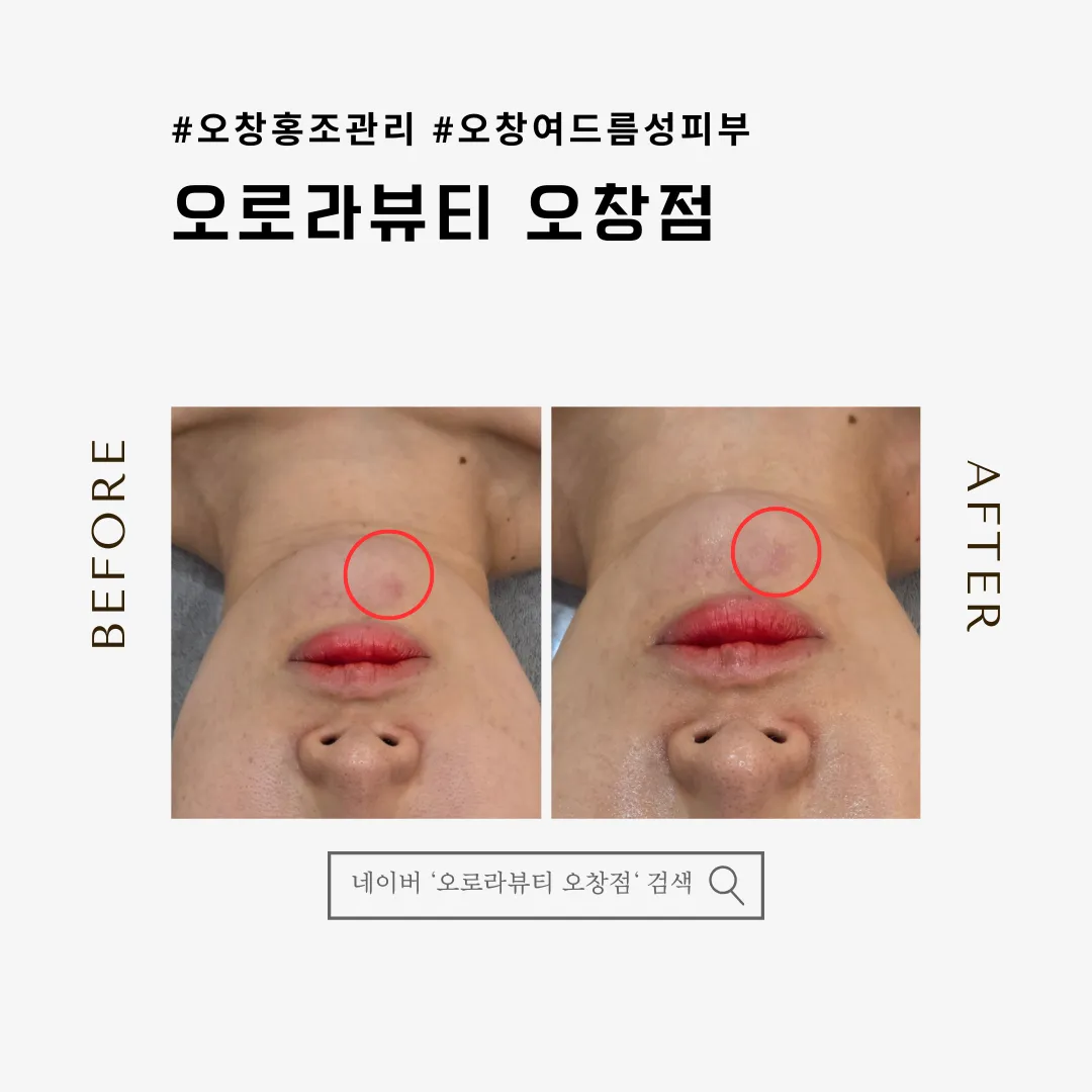 이미지 5