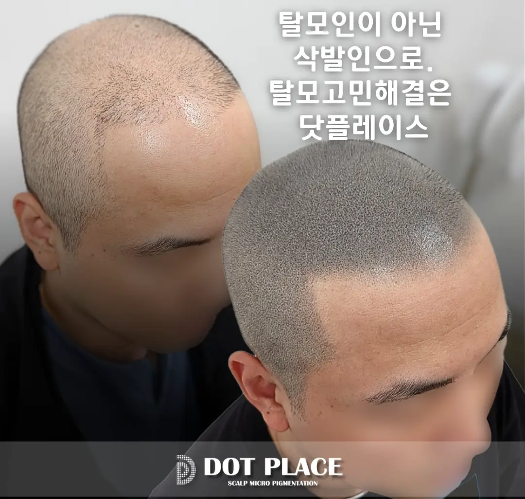 이미지 11