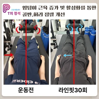 거북목,골반허리당김 개선, 라인핏30회