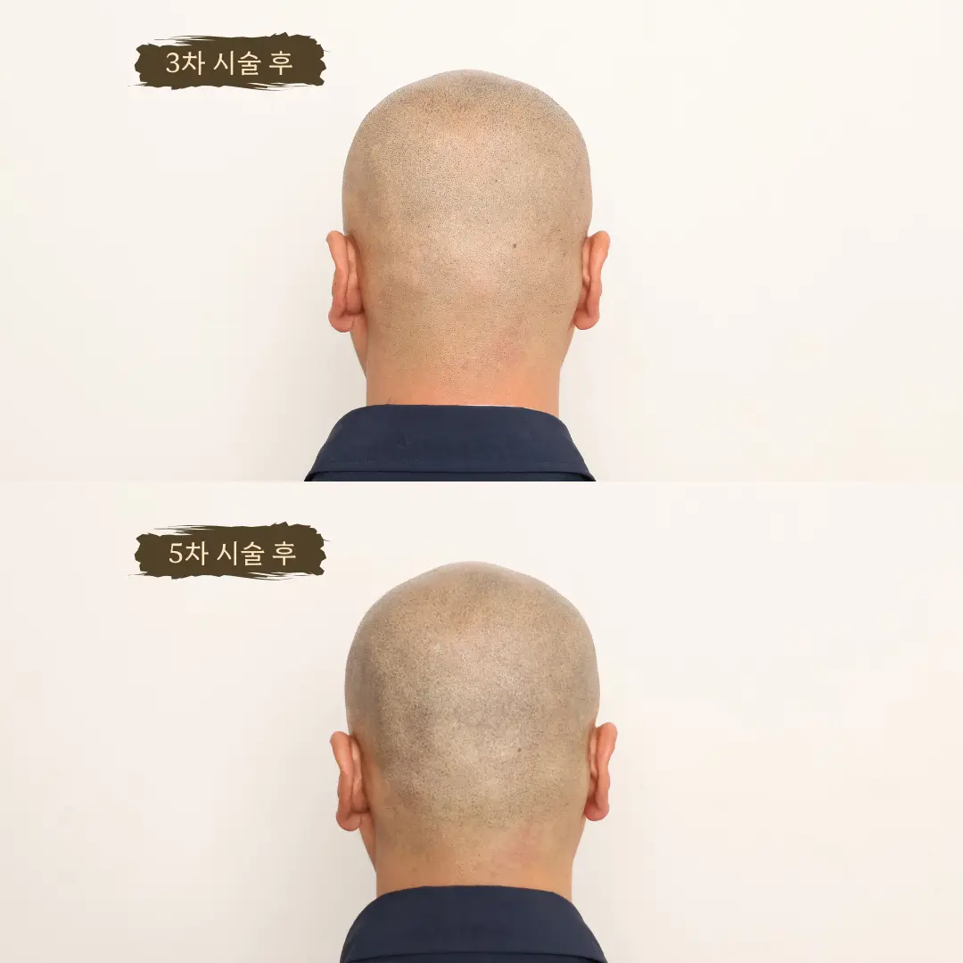 이미지 20