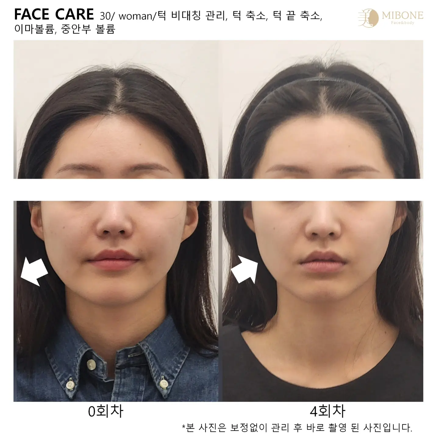 이미지 11