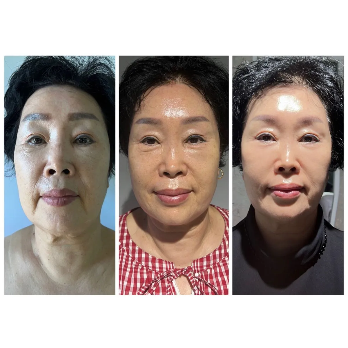 이미지 8