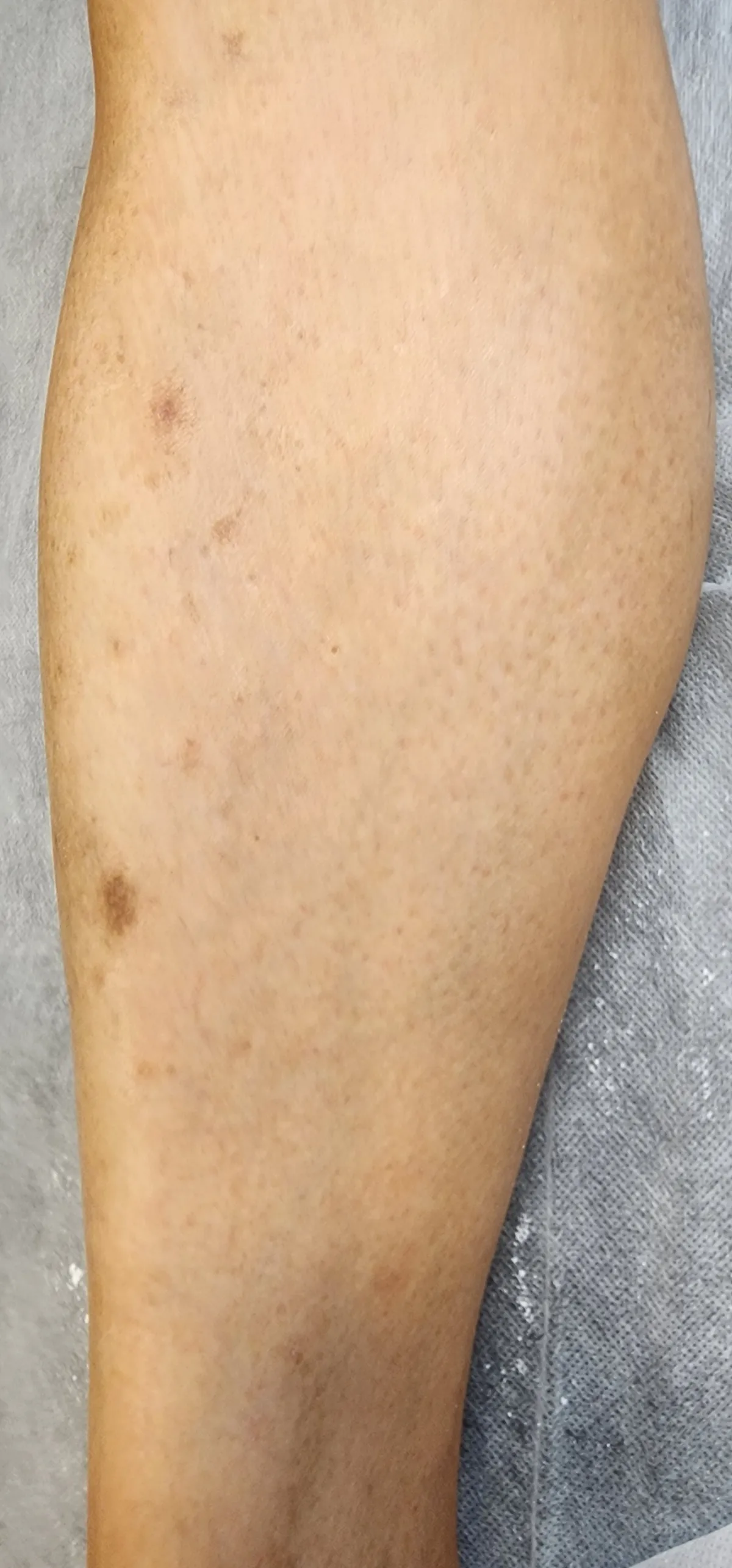 이미지 3