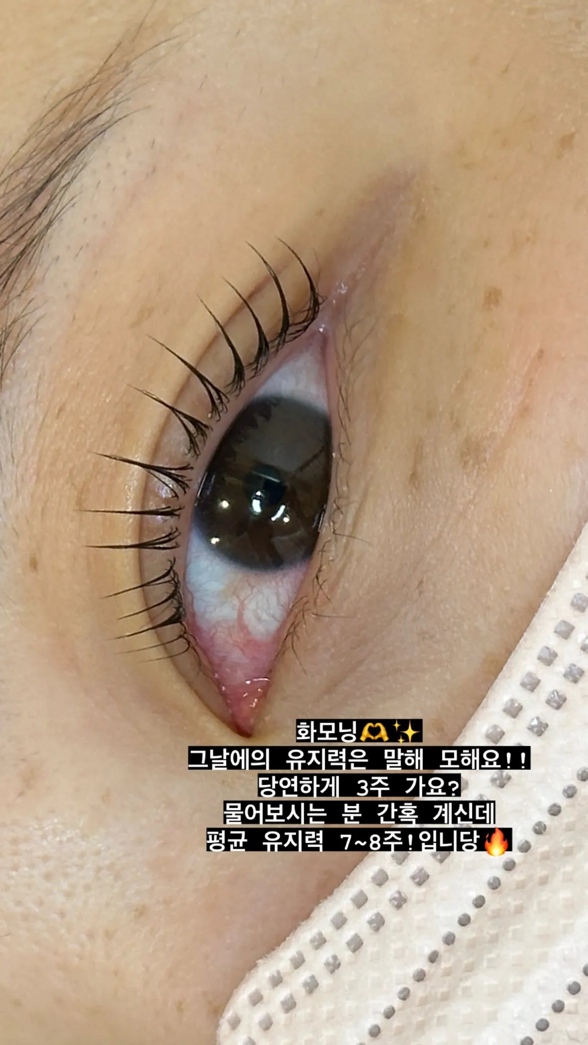 이미지 11