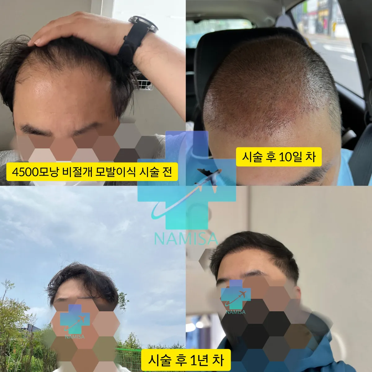 이미지 26