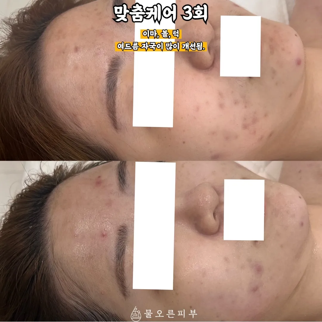 이미지 8