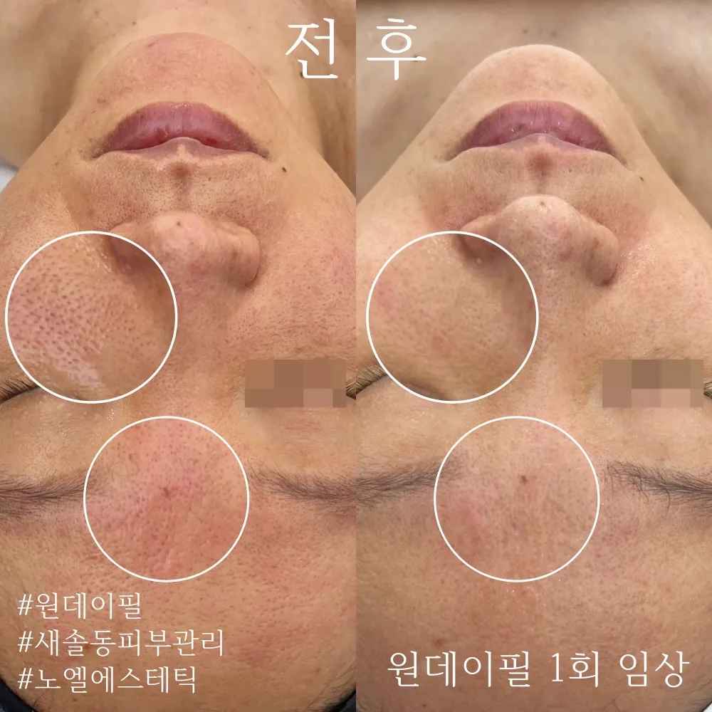 이미지 4