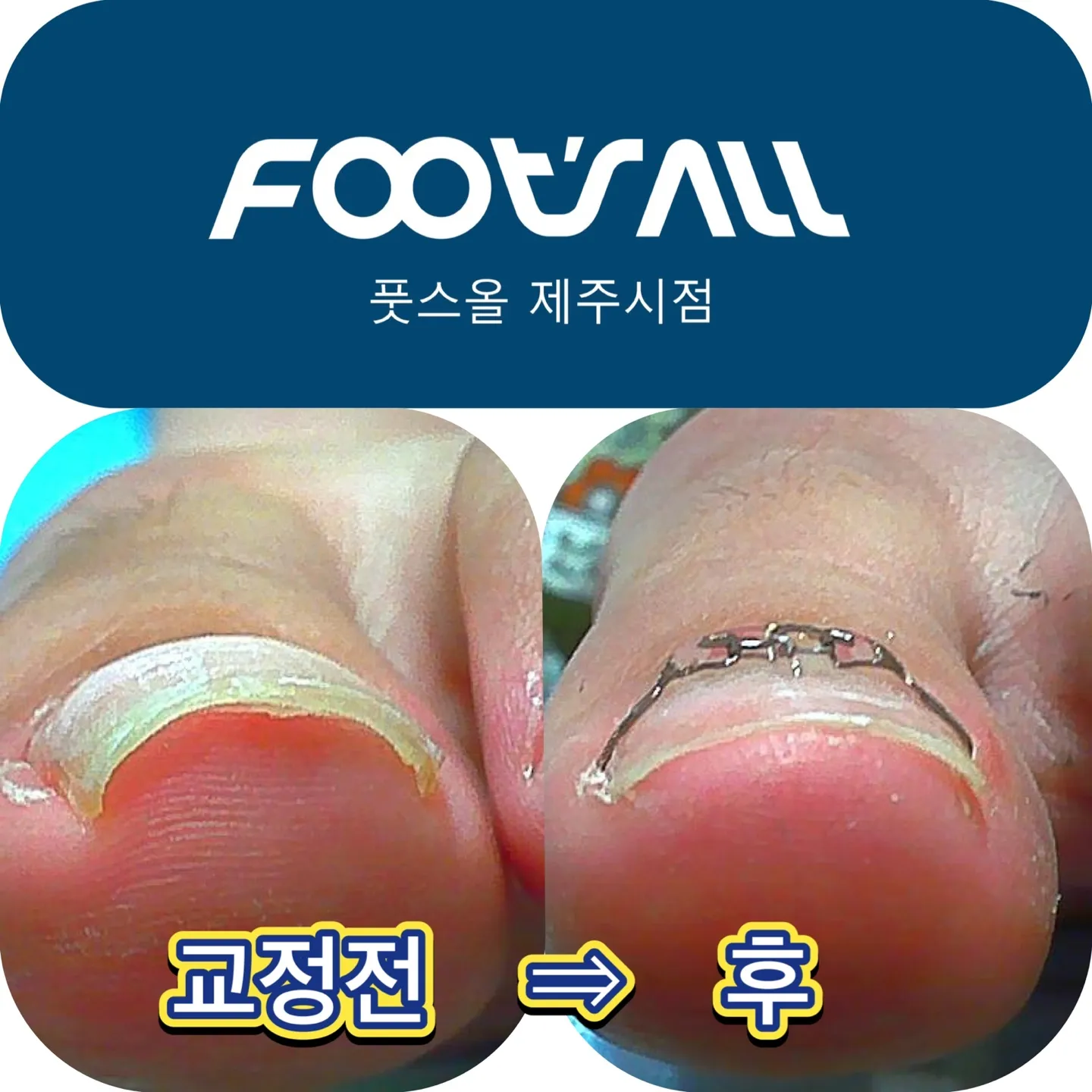 이미지 5