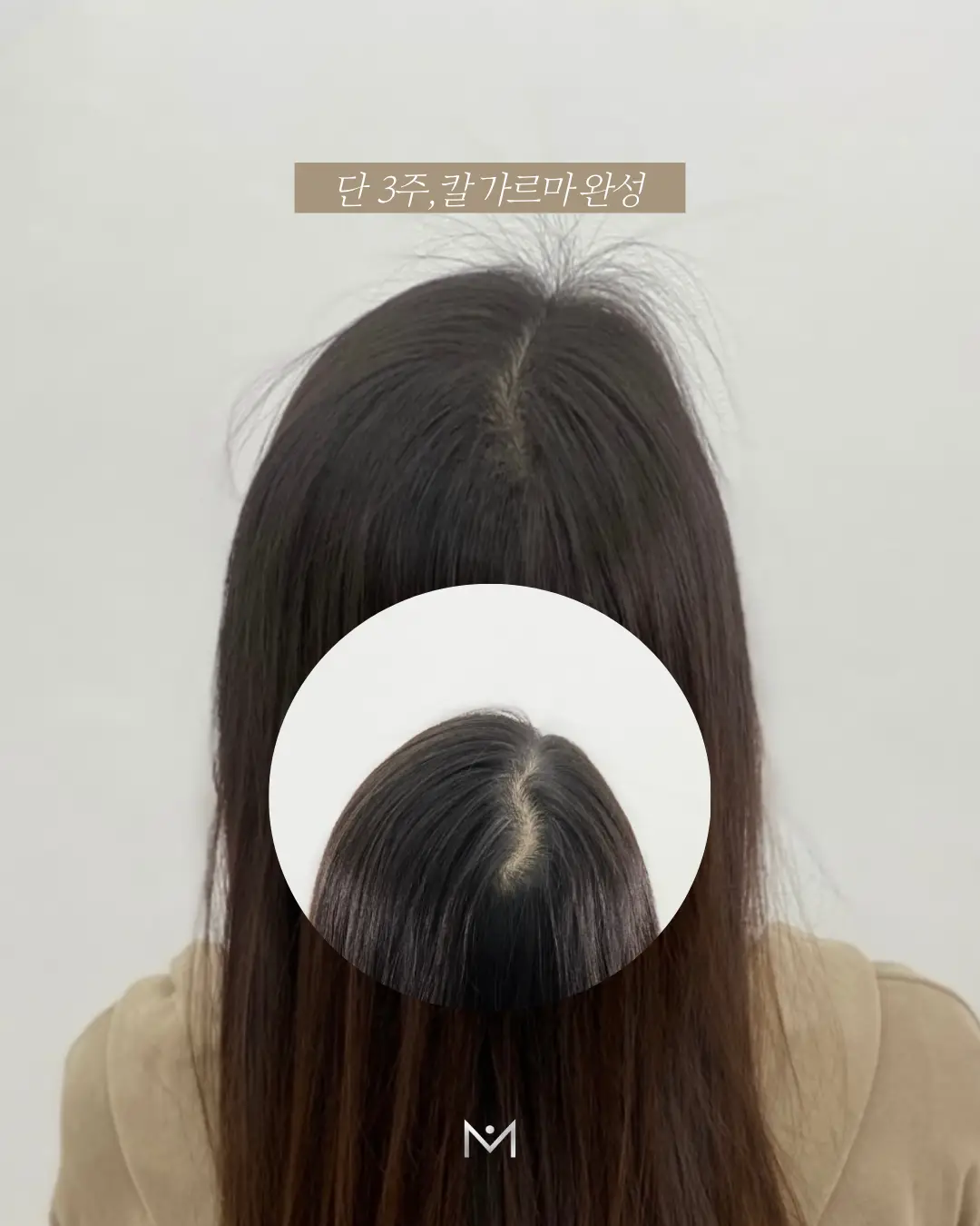 이미지 18