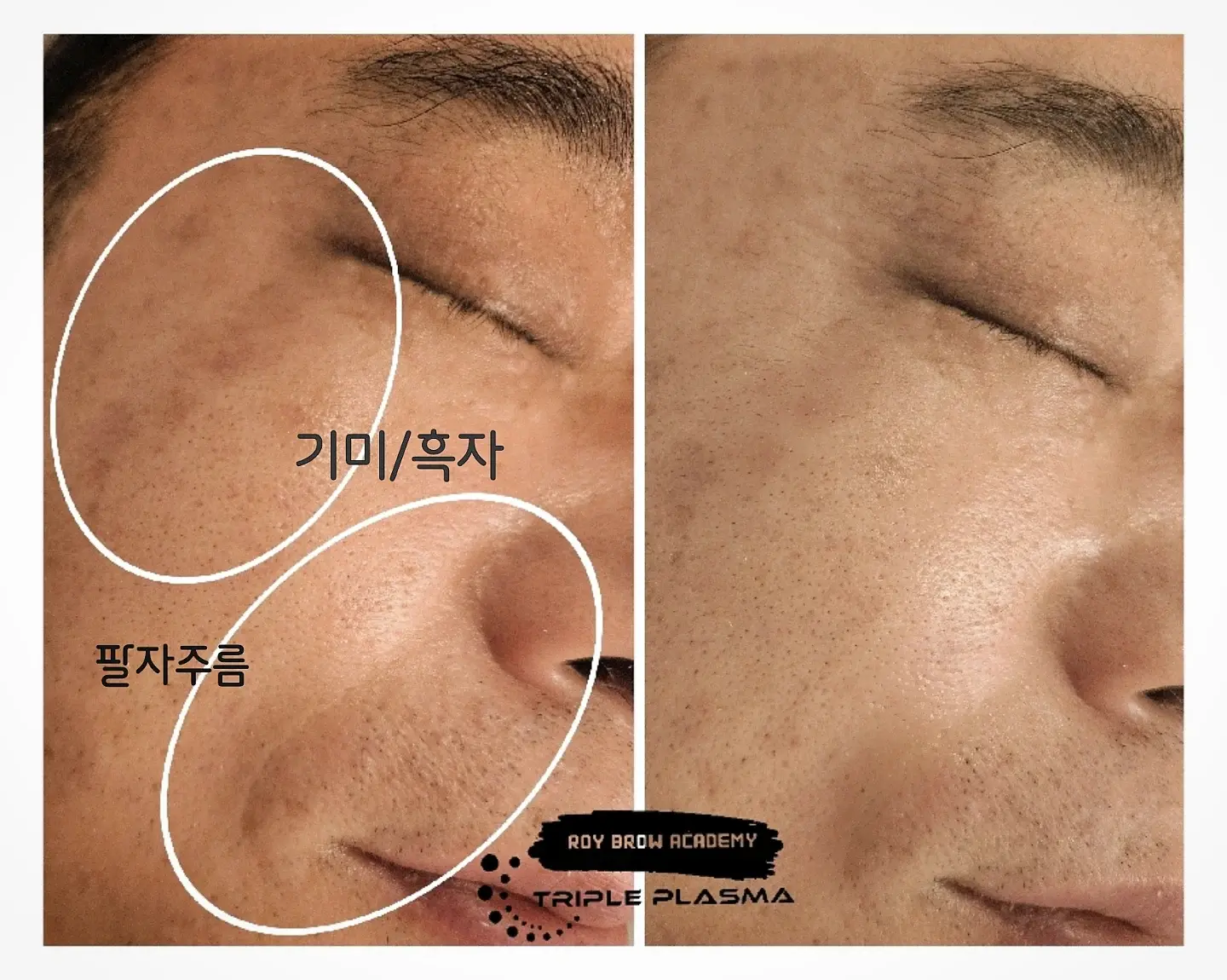 이미지 8