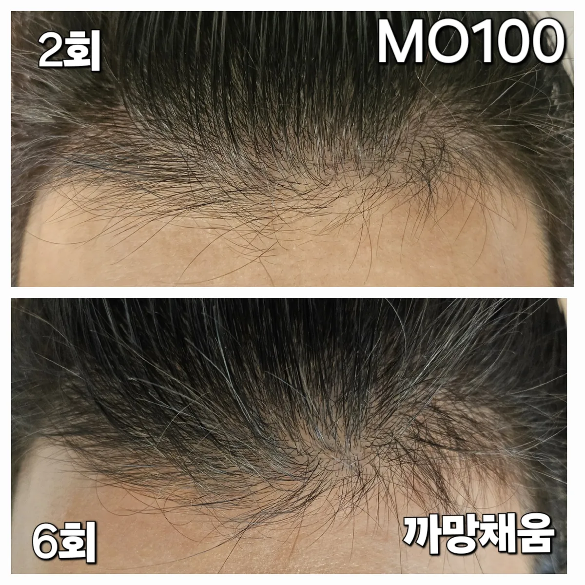 이미지 10