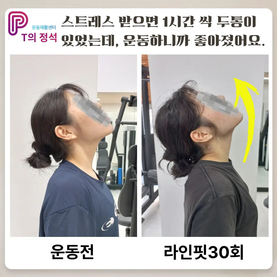 이미지 12