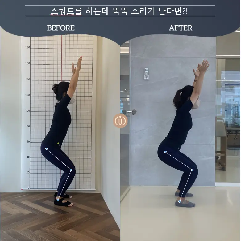 이미지 4