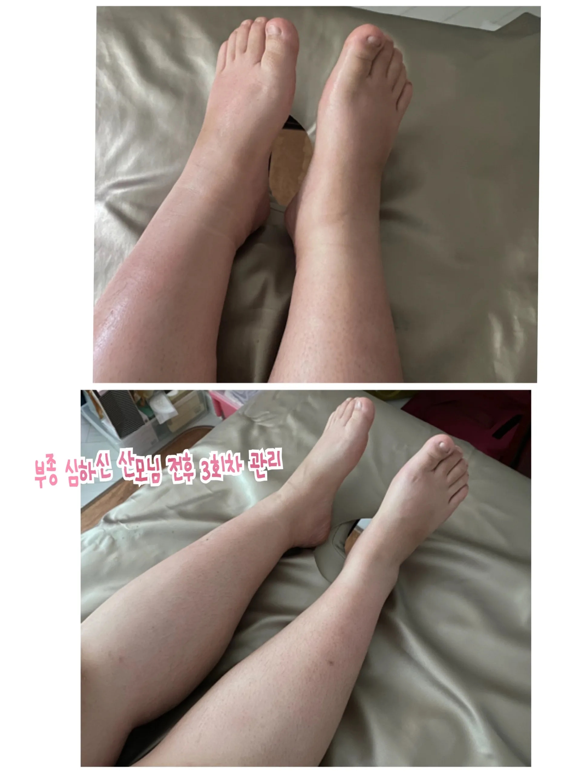 이미지 10