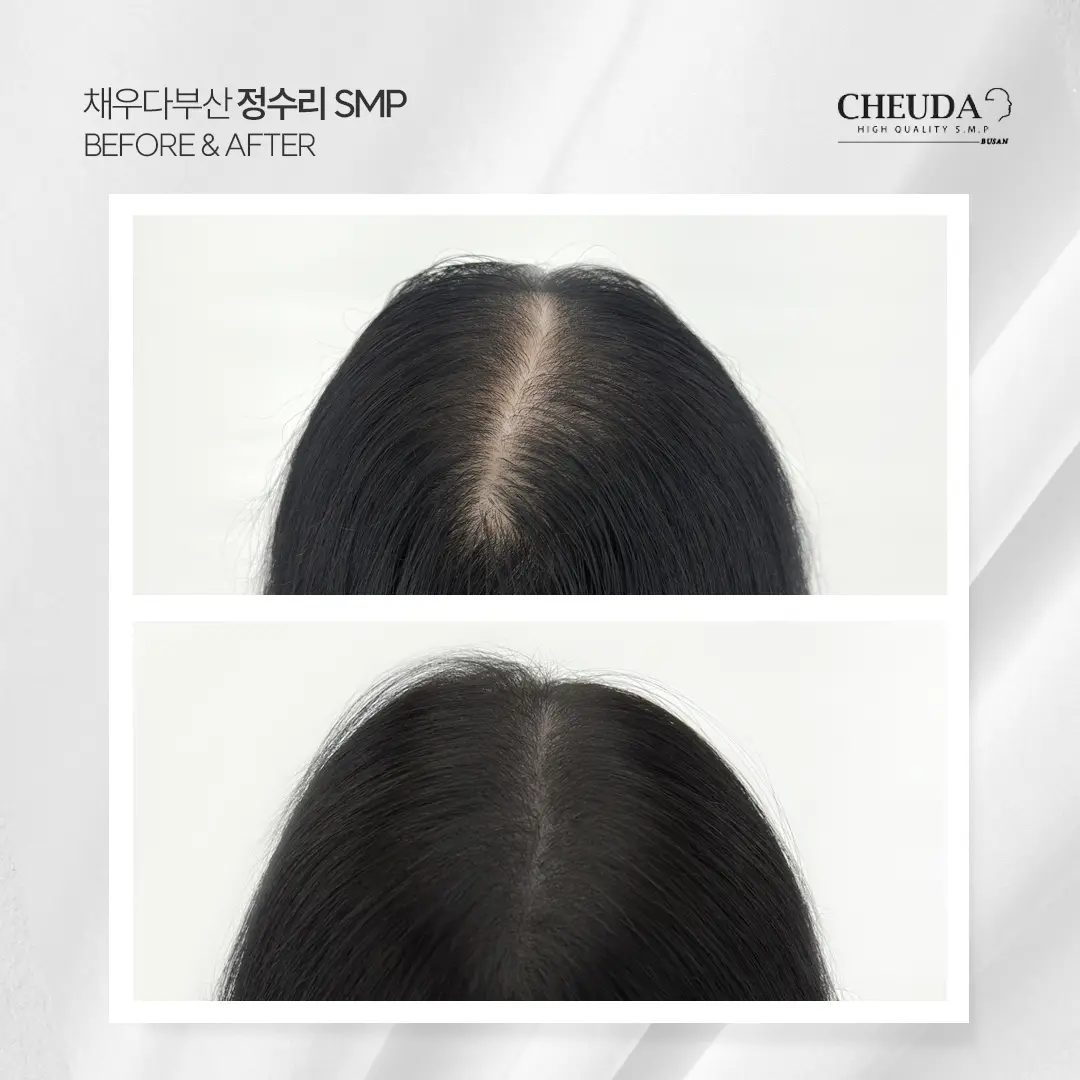 이미지 5