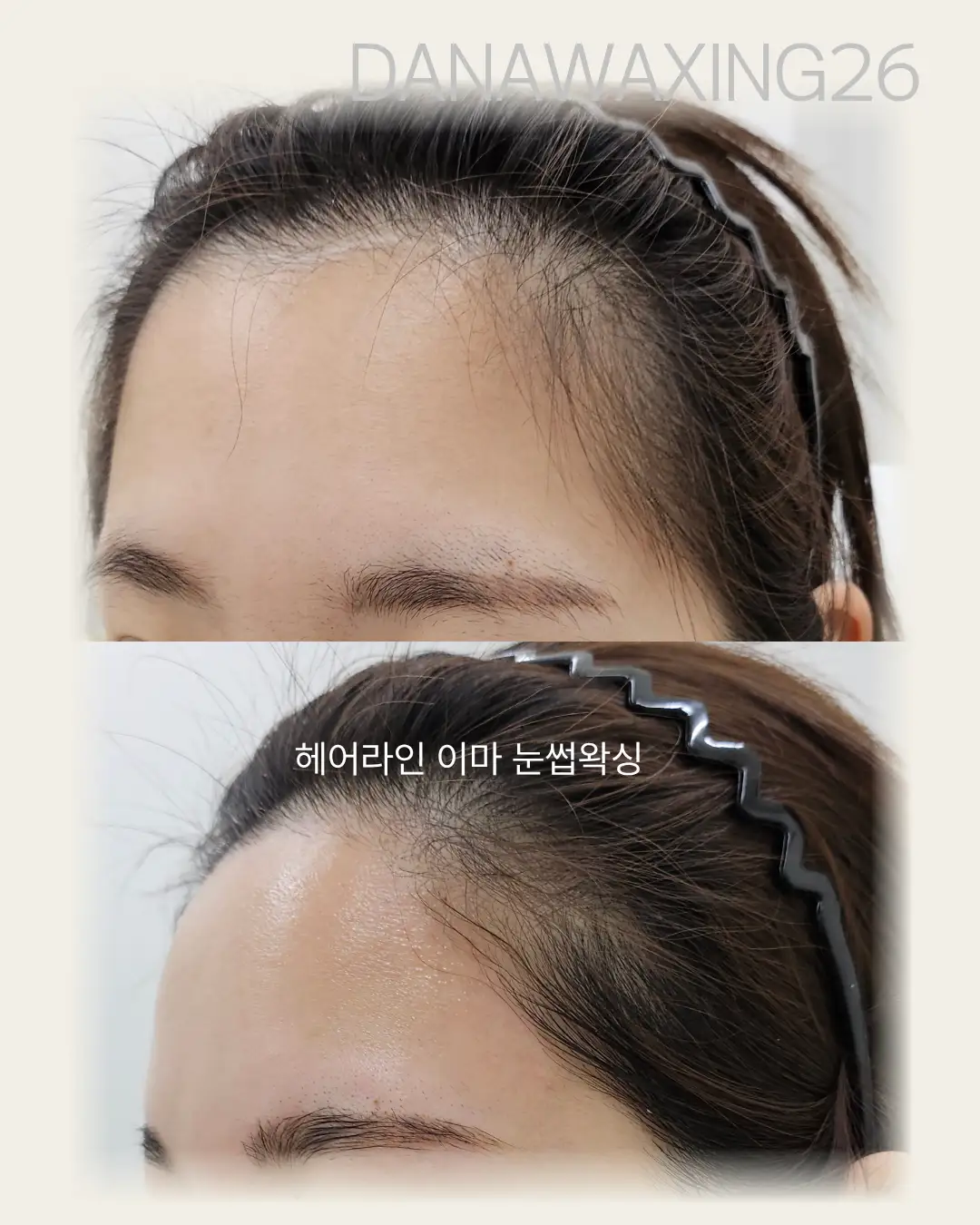 이미지 8