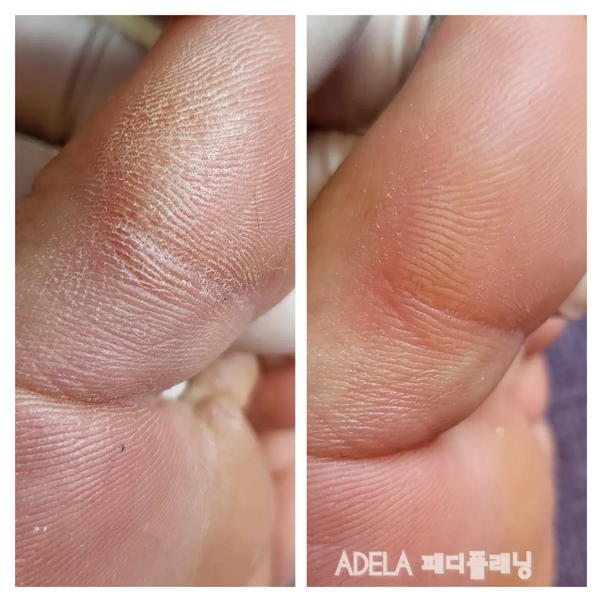 이미지 5